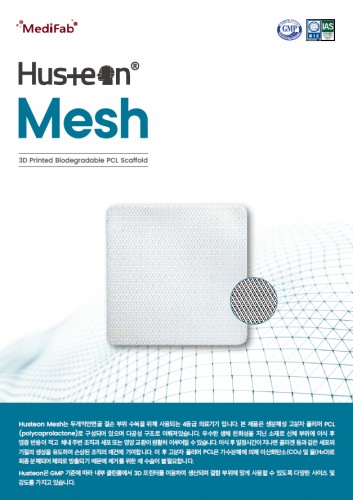 Husteon Nasal (Tissue Reconstructive Material, Synthetic, Polymer, Absorbable) 40 X 10 X 1.0 mm : The Advanced Polymer Scaffold for Nasal Reconstruction, Providing Rigid Structural Support that Gradually Absorbs to Promote Natural Tissue Regeneration